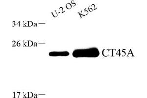 Western blot analysis of CT45A (ABIN7073596),at dilution of 1: 1500 (CT45A10 抗体)