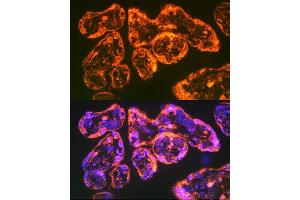 Immunofluorescence analysis of Human placenta using Integrin alpha 5 (ITG/CD49e) antibody (ABIN6131552, ABIN6142564, ABIN6142565 and ABIN6221799) at dilution of 1:100. (ITGA5 抗体  (AA 750-1000))