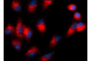 Immunofluorescence (IF) image for anti-Tetraspanin 26 (TSPAN26) (AA 112-241) antibody (PE) (ABIN5566698) (CD37 抗体  (AA 112-241) (PE))