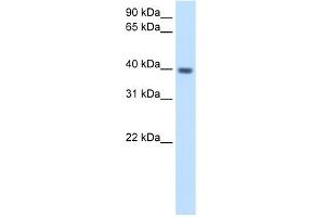 WB Suggested Anti-ITGB1BP2 Antibody Titration:  2. (ITGB1BP2 抗体  (N-Term))