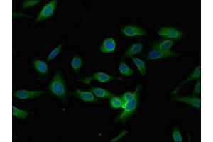 Immunofluorescent analysis of Hela cells using ABIN7163658 at dilution of 1:100 and Alexa Fluor 488-congugated AffiniPure Goat Anti-Rabbit IgG(H+L) (PLEKHO1 抗体  (AA 143-404))