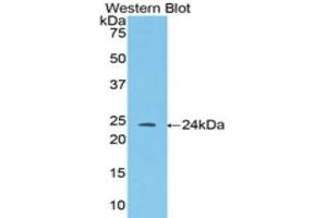 Western Blotting (WB) image for anti-Angiopoietin 1 (ANGPT1) (AA 35-231) antibody (ABIN1857990) (Angiopoietin 1 抗体  (AA 35-231))