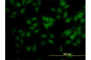 Immunofluorescence of monoclonal antibody to SCAND2 on HeLa cell. (SCAND2 抗体  (AA 1-62))