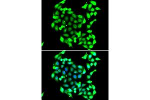 Immunofluorescence analysis of A549 cell using GTF2H3 antibody. (GTF2H3 抗体)