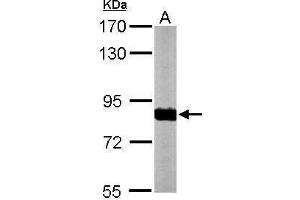Western Blotting (WB) image for anti-NADH Dehydrogenase (Ubiquinone) Fe-S Protein 1, 75kDa (NADH-Coenzyme Q Reductase) (NDUFS1) (Center) antibody (ABIN2856074)