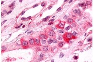 Immunohistochemistry (IHC) image for anti-Prostaglandin E Receptor 3 (Subtype EP3) (PTGER3) (Cytoplasmic Domain) antibody (ABIN1049256)