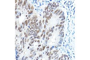 Immunohistochemistry (IHC) image for anti-Forkhead Box A1 (FOXA1) (AA 263-472) antibody (ABIN7267231)