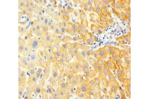 Immunohistochemistry of paraffin-embedded human liver tissue using ABIN7153912 at dilution of 1:100 (G6PC 抗体  (AA 82-117))