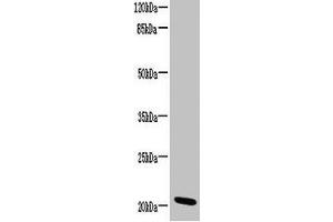 Western blot All lanes: CCDC32 antibody at 2 μg/mL + HL60 whole cell lysate Secondary Goat polyclonal to rabbit IgG at 1/10000 dilution Predicted band size: 21, 22, 16 kDa Observed band size: 21 kDa (C15ORF57 抗体  (AA 1-185))