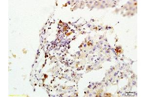 Immunohistochemistry (Paraffin-embedded Sections) (IHC (p)) image for anti-O6-Methylguanine-DNA-Methyltransferase (MGMT) (AA 101-207) antibody (ABIN730768)