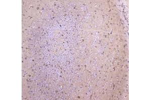 IHC testing of FFPE mouse brain tissue with WWOX antibody at 1ug/ml. (WWOX 抗体)