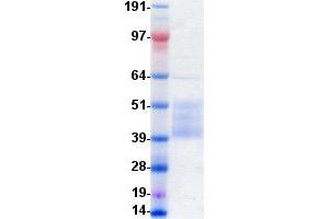 Western Blotting (WB) image for Insulin-Like Growth Factor 1 Receptor (IGF1R) protein (DYKDDDDK-His Tag) (ABIN2713510)