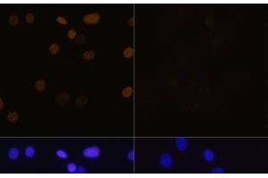 Immunofluorescence analysis of C6 cells using Acetyl-Histone H4-K16 Polyclonal Antibody at dilution of 1:100. (Histone H4 抗体  (acLys16))