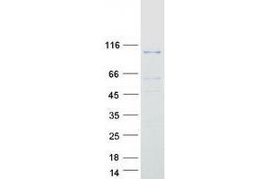 Western Blotting (WB) image for DAG Kinase gamma (Transcript Variant 2) protein (Myc-DYKDDDDK Tag) (ABIN2719198)