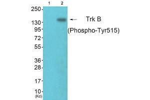 Western Blotting (WB) image for anti-Neurotrophic Tyrosine Kinase, Receptor, Type 2 (NTRK2) (pTyr515) antibody (ABIN1847226) (TRKB 抗体  (pTyr515))