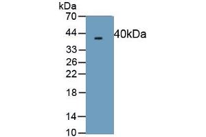 Detection of Recombinant PINP, Human using Monoclonal Antibody to Procollagen I N-Terminal Propeptide (PINP) (PINP 抗体)
