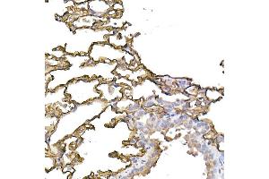 Immunohistochemistry of paraffin-embedded human tonsil using ICAM-1/CD54 Rabbit pAb (ABIN6129231, ABIN6142118, ABIN6142120 and ABIN6221235) at dilution of 1:100 (40x lens). (ICAM1 抗体  (AA 250-480))