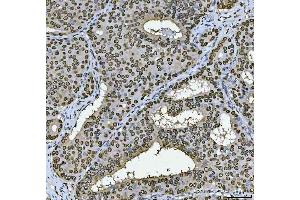 IHC analysis of PC4/SUB1 using anti-PC4/SUB1 antibody (ABIN7602185).