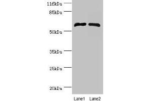 Western blot All lanes: CYP4F11 antibody at 2 μg/mL Lane 1: Mouse liver tissue Lane 2: Mouse kidney tissue Secondary Goat polyclonal to rabbit IgG at 1/10000 dilution Predicted band size: 61 kDa Observed band size: 61 kDa (CYP4F11 抗体  (AA 38-524))