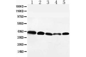 Anti-GPR2/CCR10 antibody, Western blotting Lane 1: HELA Cell Lysate Lane 2: SW620 Cell Lysate Lane 3: A549 Cell Lysate Lane 4: MM231 Cell Lysate Lane 5: SMMC Cell Lysate (CCR10 抗体  (C-Term))