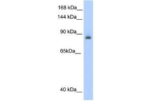 WB Suggested Anti-ACO1 Antibody Titration:  0. (Aconitase 1 抗体  (N-Term))