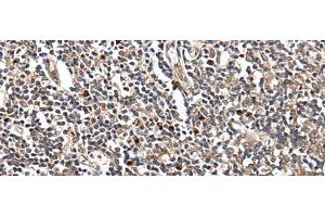 Immunohistochemistry of paraffin-embedded Human tonsil tissue using HOXB9 Polyclonal Antibody at dilution of 1:45(x200) (HOXB9 抗体)