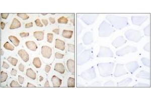 Immunohistochemistry analysis of paraffin-embedded human skeletal muscle tissue, using CHOP (Ab-30) Antibody. (DDIT3 抗体  (AA 15-64))