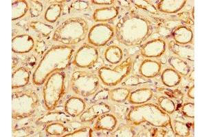 Immunohistochemistry of paraffin-embedded human kidney tissue using ABIN7151711 at dilution of 1:100 (LACTB2 抗体  (AA 6-288))