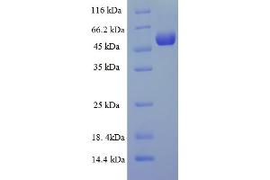 SDS-PAGE (SDS) image for Matrix Metallopeptidase 13 (Collagenase 3) (MMP13) (AA 104-471) protein (His-SUMO Tag) (ABIN5709941) (MMP13 Protein (AA 104-471) (His-SUMO Tag))