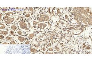 Immunohistochemistry of paraffin-embedded Human stomach tissue using CAV1 Polyclonal Antibody at dilution of 1:200. (Caveolin-1 抗体)