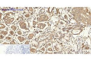 Immunohistochemistry of paraffin-embedded Human stomach tissue using CAV1 Polyclonal Antibody at dilution of 1:200.