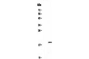 Western blot analysis of IL32 using anti-IL32 antibody . (IL32 抗体  (AA 31-234))