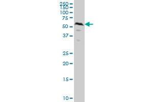 SMAD1 monoclonal antibody (M04A), clone 2A1 Western Blot analysis of SMAD1 expression in HeLa . (SMAD1 抗体  (AA 1-465))