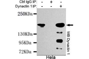 Immunoprecipitation analysis of Hela cell lysates using Dynactin 1 mouse mAb. (Dynactin 1 抗体  (N-Term))