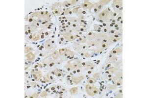 Immunohistochemistry (Paraffin-embedded Sections) (IHC (p)) image for anti-Mitogen-Activated Protein Kinase 8 (MAPK8) (AA 245-345) antibody (ABIN3020887)