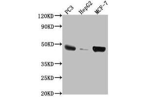 Western Blot Positive WB detected in: PC3 whole cell lysate, HepG2 whole cell lysate, MCF-7 whole cell lysate All lanes: TNFRSF25 antibody at 1:2000 Secondary Goat polyclonal to rabbit IgG at 1/50000 dilution Predicted band size: 46, 24, 28, 20, 15, 14, 26, 41, 42, 30 kDa Observed band size: 46 kDa