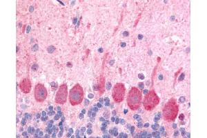 Anti-HCRTR1 / Orexin Receptor 1 antibody IHC of rat brain, Purkinje neurons. (HCRTR1 抗体  (Extracellular Domain))