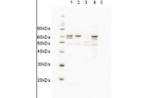 Western blot showing anti-HR23A antibody detects endogenous human HR23A. (RAD23A 抗体  (AA 122-135))