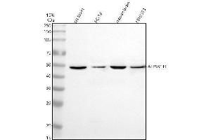 Western blot analysis of ATP6V1H using anti-ATP6V1H antibody (ABIN7825279).