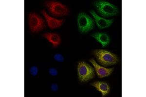 ABIN6259873 and ABIN6273990 staining Hela cells by IF/ICC. (ALAS1 抗体  (Internal Region))