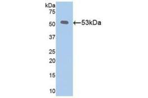 Detection of KL in Recombinant Klotho, Mouse using Polyclonal Antibody to Klotho (KL)