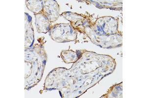 Immunohistochemistry (IHC) image for anti-Ectonucleoside Triphosphate diphosphohydrolase 1 (ENTPD1) (AA 1-180) antibody (ABIN1679729)