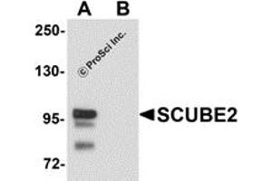 Western Blotting (WB) image for anti-Signal Peptide, CUB Domain, EGF-Like 2 (SCUBE2) (Middle Region) antibody (ABIN1031083) (SCUBE2 抗体  (Middle Region))