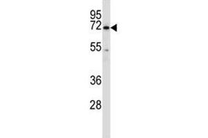 Western Blotting (WB) image for anti-Bruton Agammaglobulinemia tyrosine Kinase (BTK) (AA 27-55) antibody (ABIN3030207)