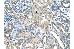 PRPS2 antibody was used for immunohistochemistry at a concentration of 4-8 ug/ml to stain Epithelial cells of renal tubule (arrows) in Human Kidney. (PRPS2 抗体  (Middle Region))