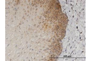 Immunostaining (ISt) image for anti-Melanoma Antigen Family D, 1 (MAGED1) (AA 117-226) antibody (ABIN522983)