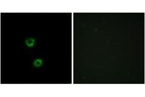 Immunofluorescence analysis of MCF7 cells, using TMEM30C Antibody. (TMEM30C 抗体  (AA 51-100))