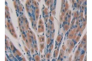 Immunohistochemistry (IHC) image for anti-Cytochrome P450, Family 24, Subfamily A, Polypeptide 1 (CYP24A1) (AA 260-514) antibody (ABIN7440206)