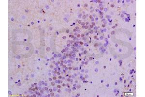Immunohistochemistry (IHC) image for anti-Protein Kinase, AMP-Activated, alpha 1 Catalytic Subunit (PRKAA1) (AA 351-450) antibody (ABIN737886)