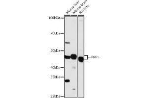 Western blot analysis of extracts of various cell lines, using PRR5 antibody (ABIN7269555) at 1:1000 dilution. (PRR5 抗体  (AA 109-388))